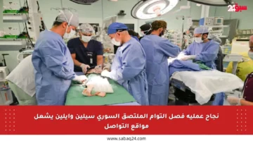 نجاح عملية فصل التوأم الملتصق السوري سيلين وإيلين يشعل مواقع التواصل